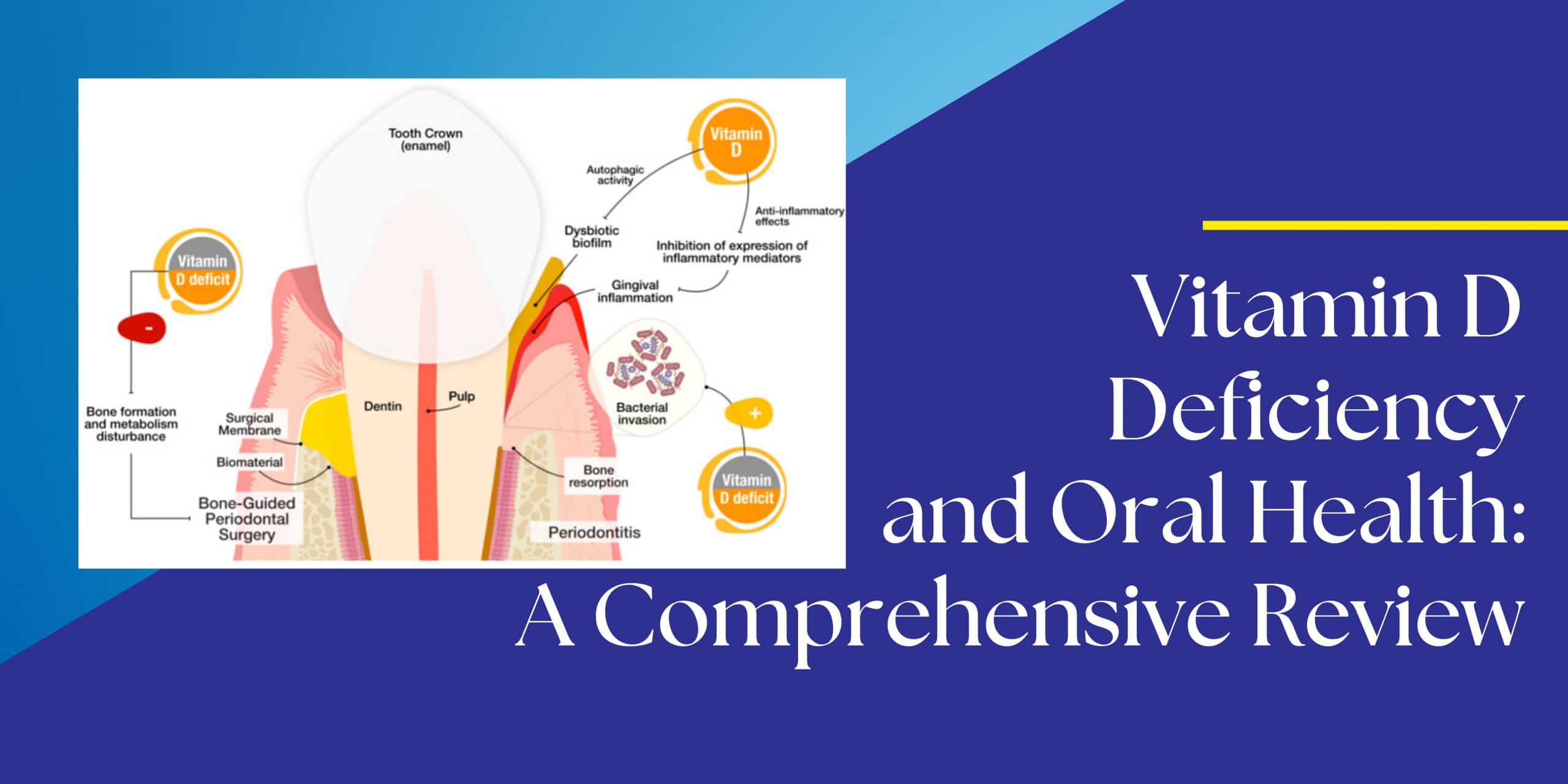 Vitamin D Deficiency and Oral Health: A Comprehensive Review - DentaMedica
