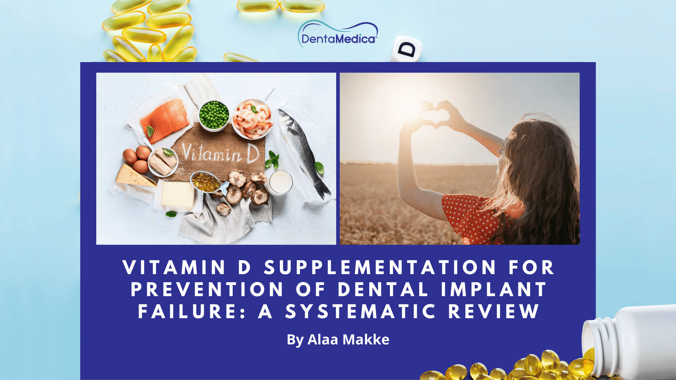 Vitamin D Supplementation for Prevention of Dental Implant Failure: A  Systematic Review - DentaMedica